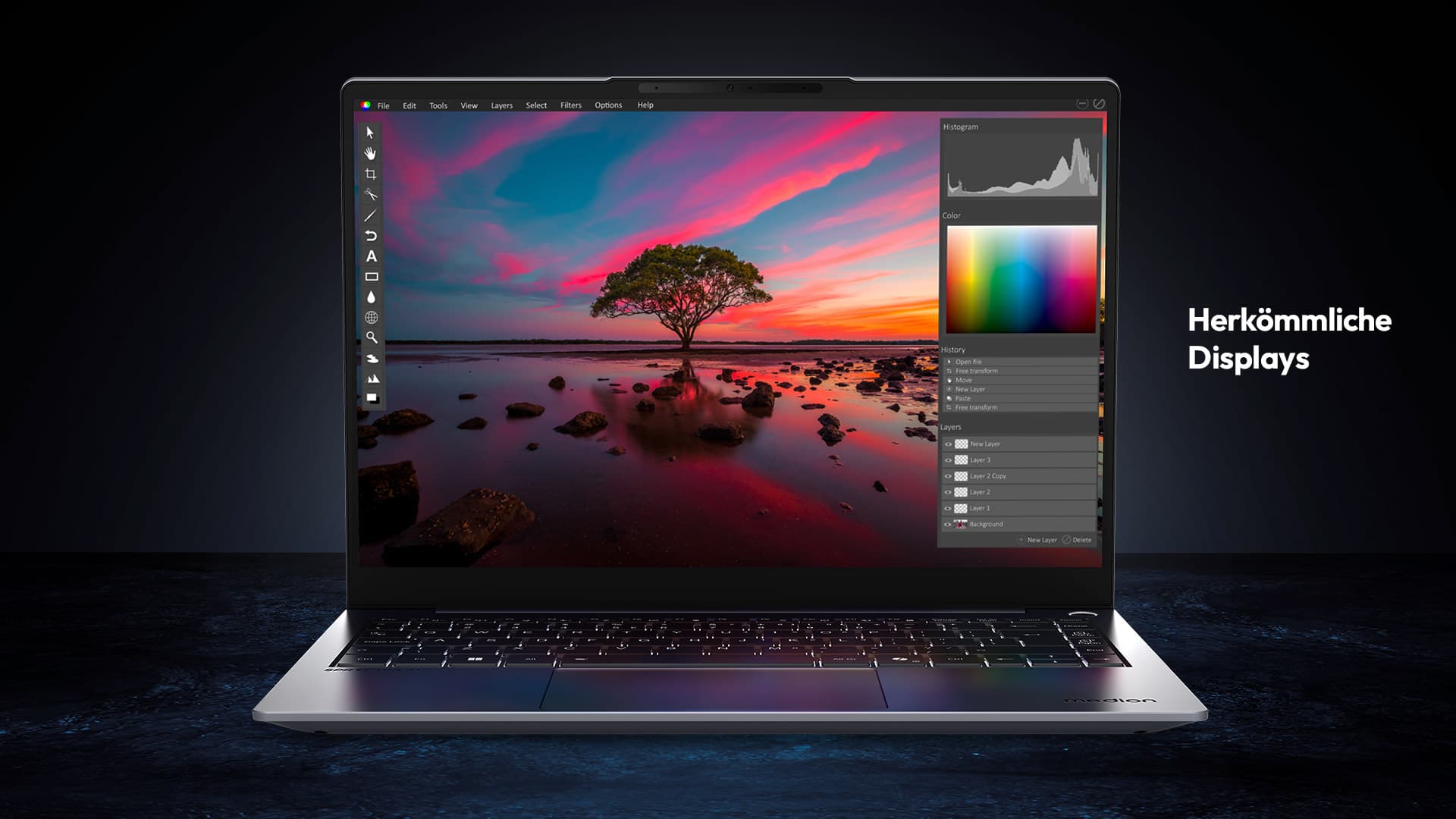Placeholder for alt text